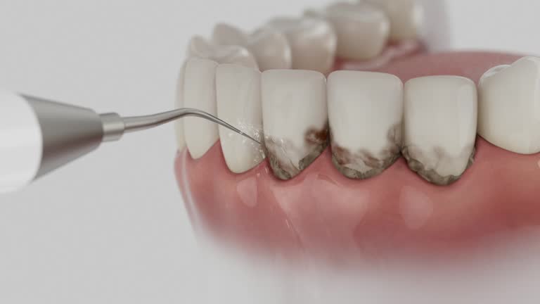 Trusted Teeth Whitening service in Big Spring, TX - Dentist Open Now